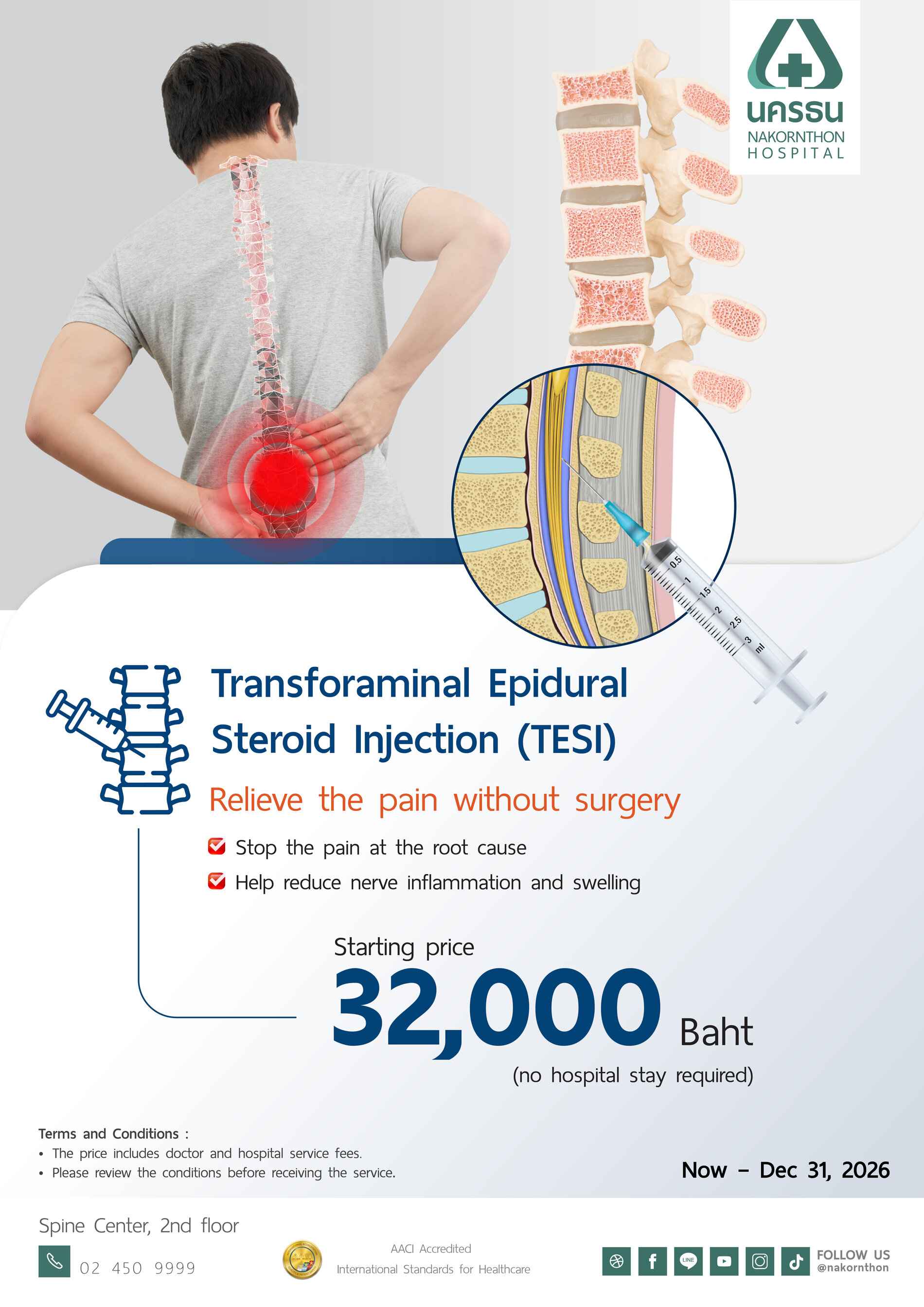 Transforaminal Epidural Steroid Injection (TESI)