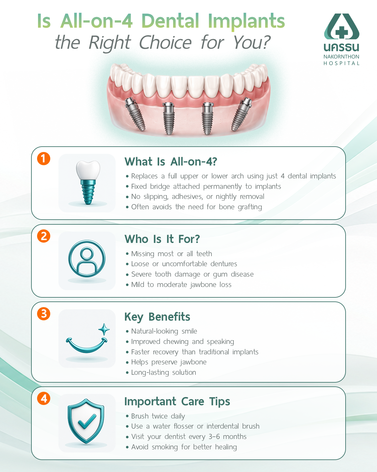 What Are All-on-4 Dental Implants?