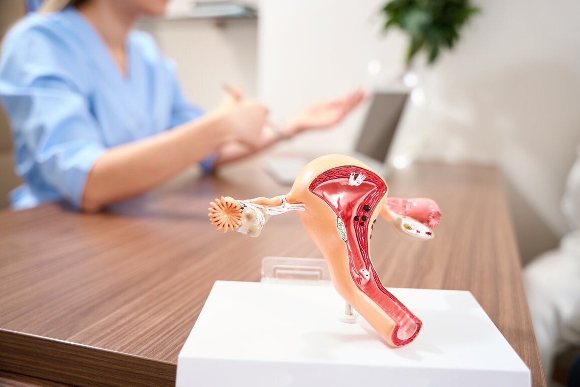 treatment for Uterine fibroid