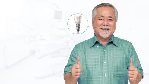 Benefits of Dental Implant