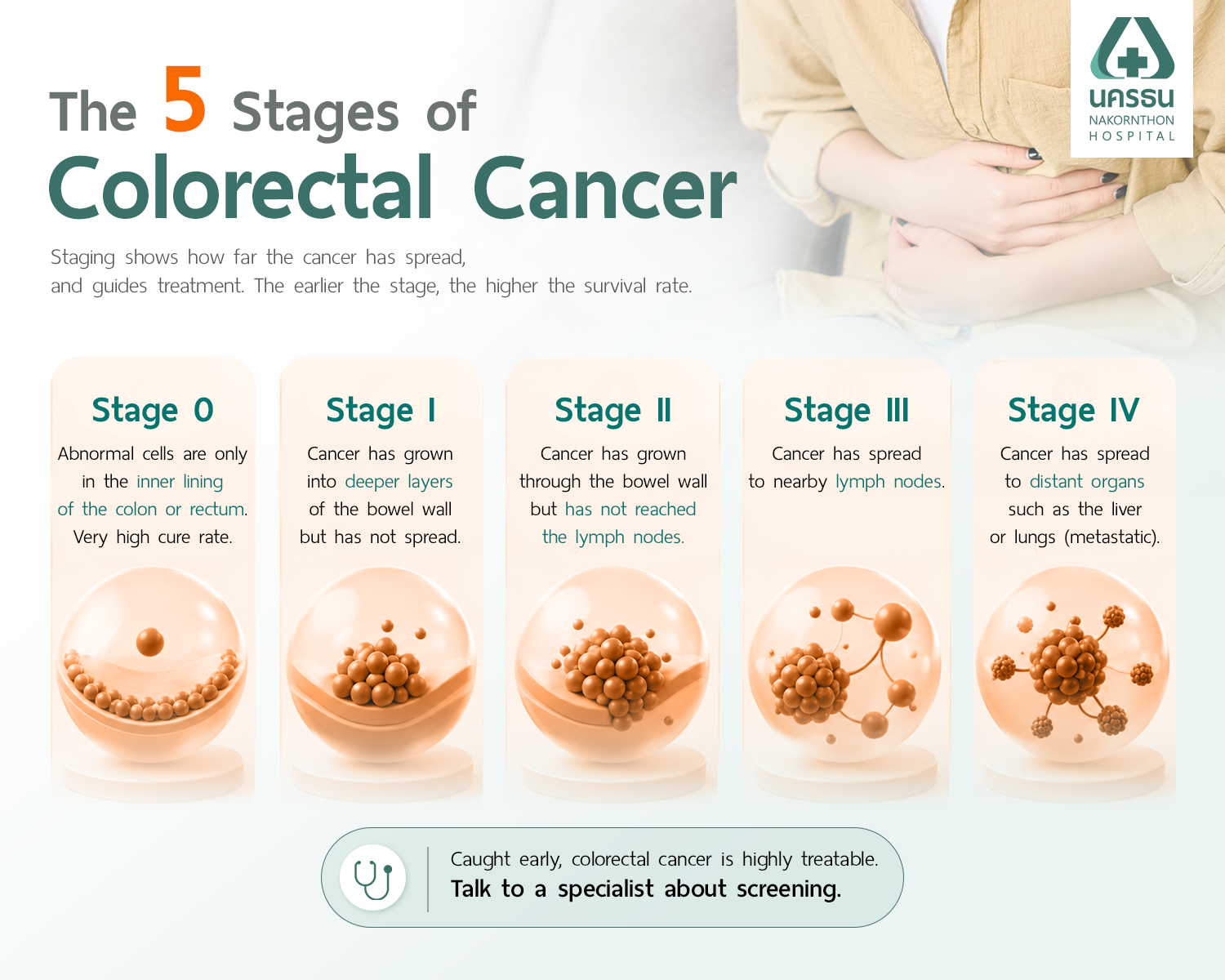 Infographic showing the five stages of colorectal cancer, from Stage 0 confined to the inner lining through to Stage IV spread to distant organs.