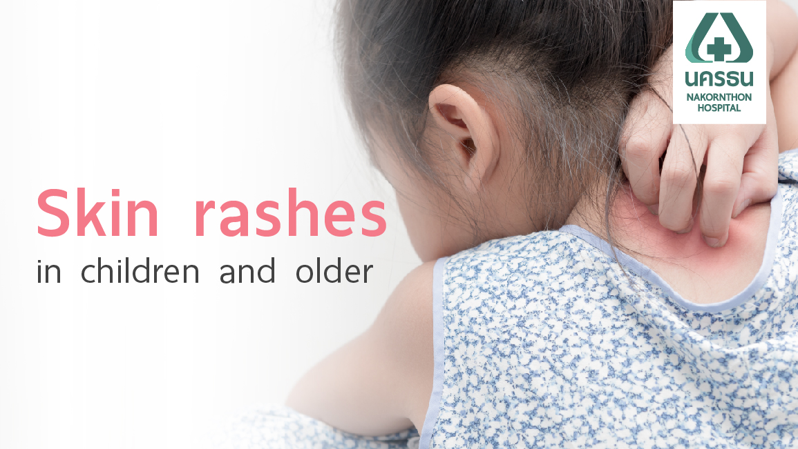 Skin rashes in children