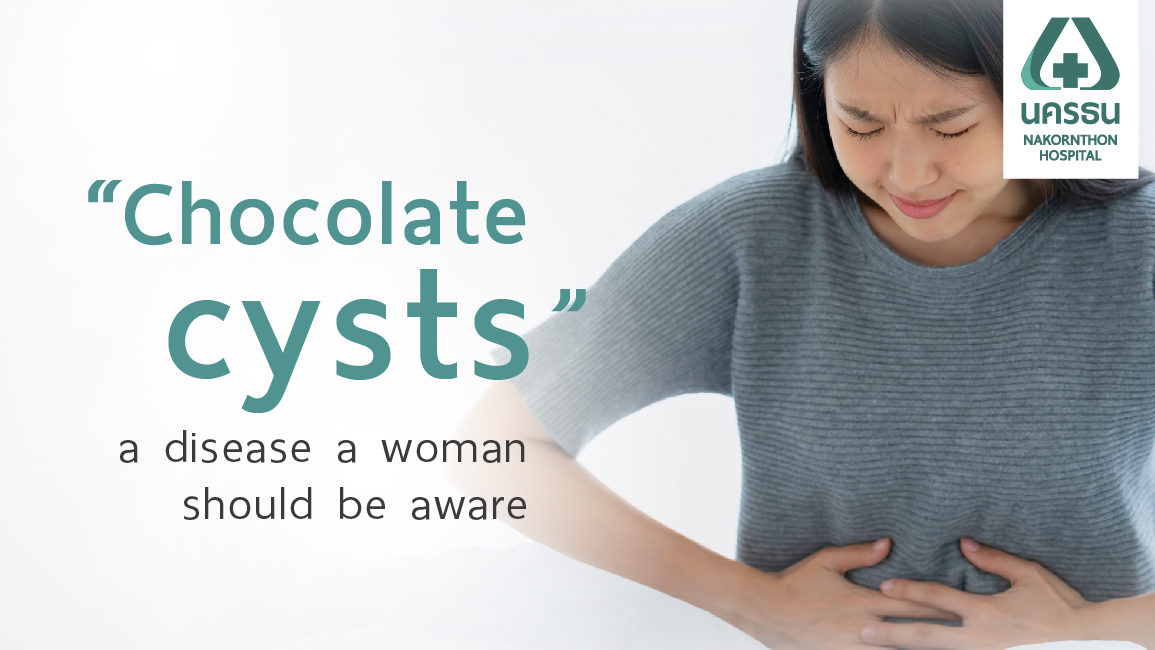 Chocolate Cysts : Causes, Symptoms & Treatment