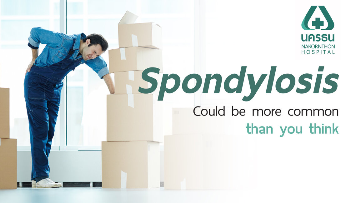 Spondylosis Spondylosis