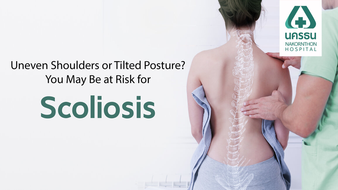 Scoliosis Scoliosis