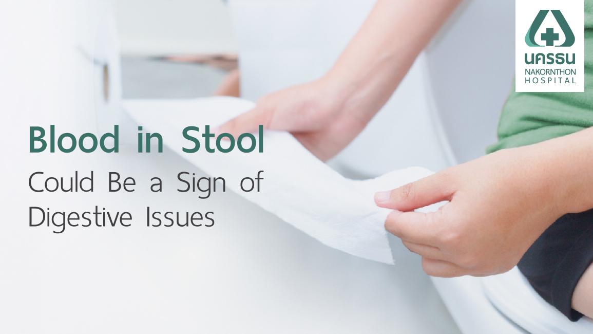 Blood in stool Blood in stool