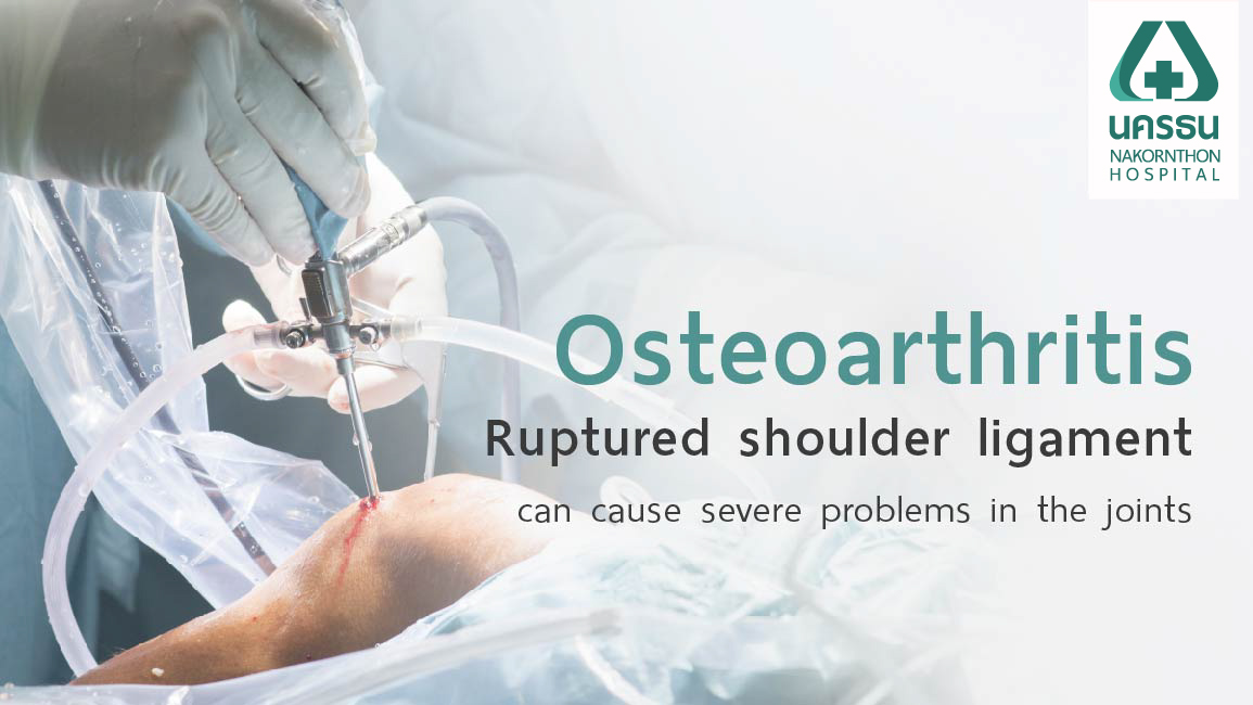 Arthroscopic vs open surgery for osteoarthritis treatment